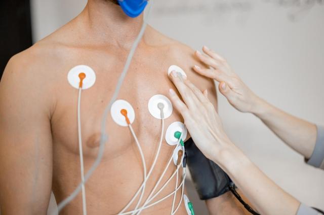 Holter Monitoring